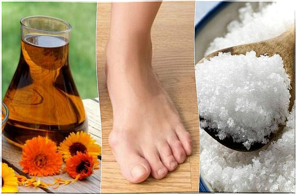 4 natural solutions to reduce bunions