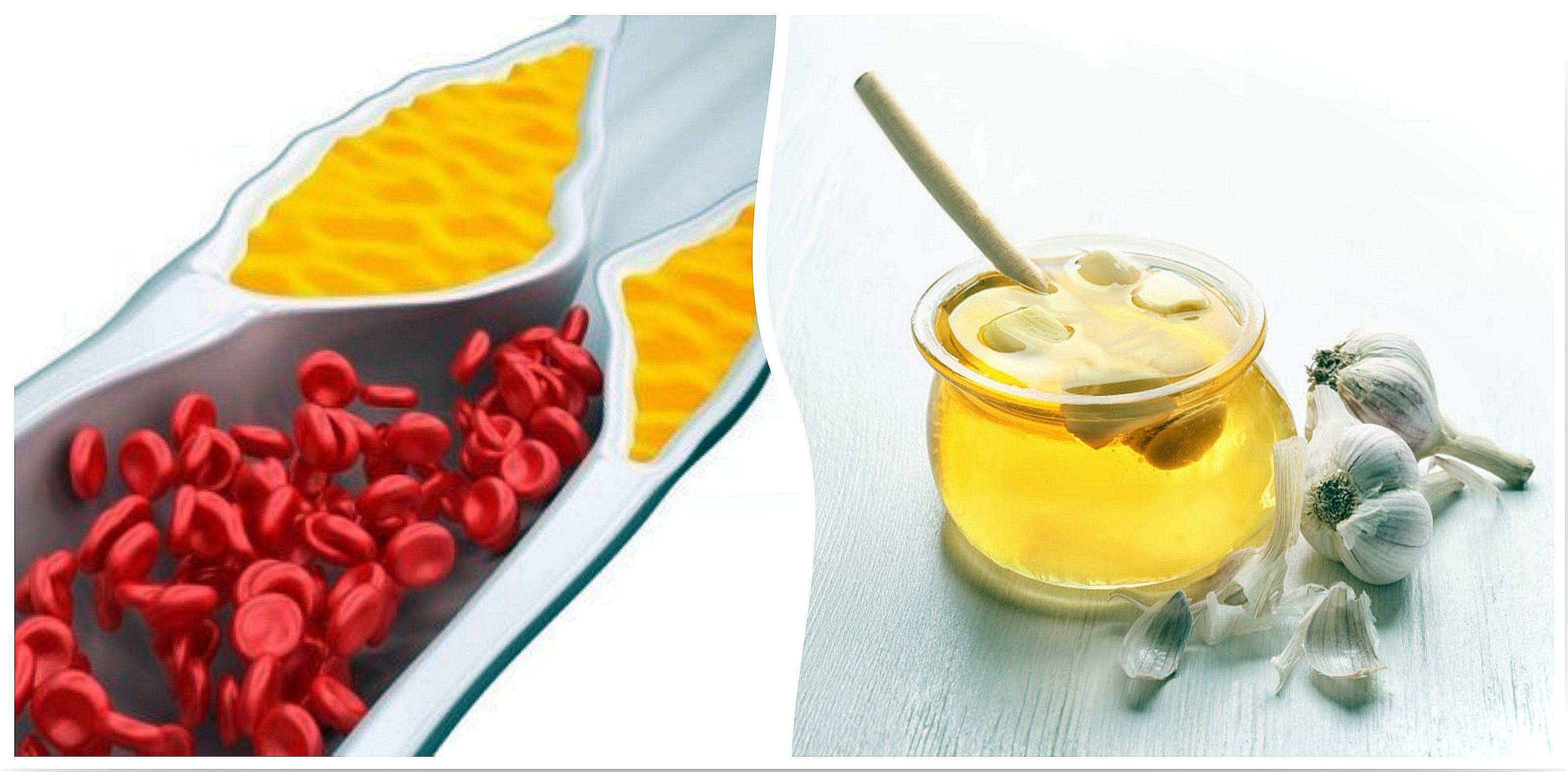 How to prepare a syrup to reduce cholesterol and reduce inflammation of the joints