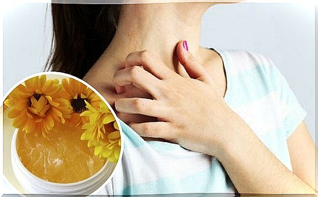 Learn how to make a homemade and natural balm for eczema