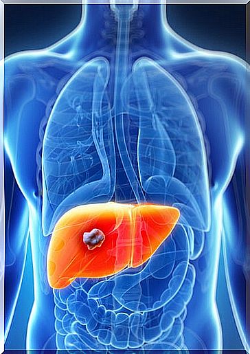 symptoms of liver cancer