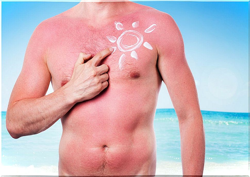 Sun and skin cancer, what relationship is there?