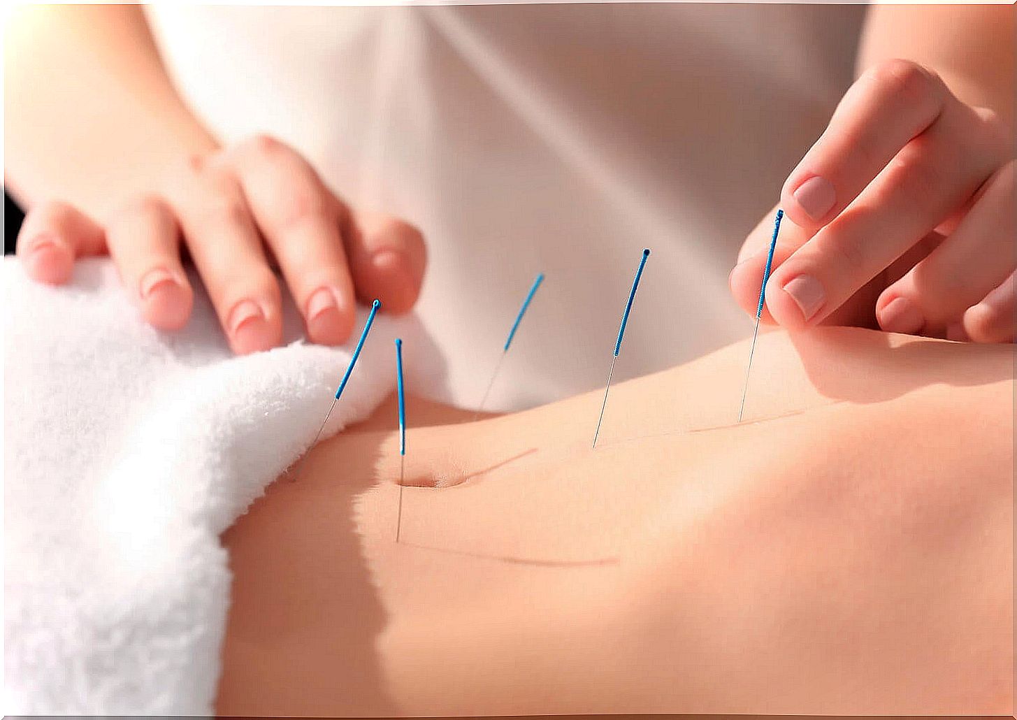 Acupuncture benefits